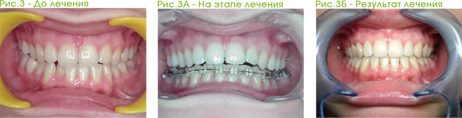 ортодонтия 03